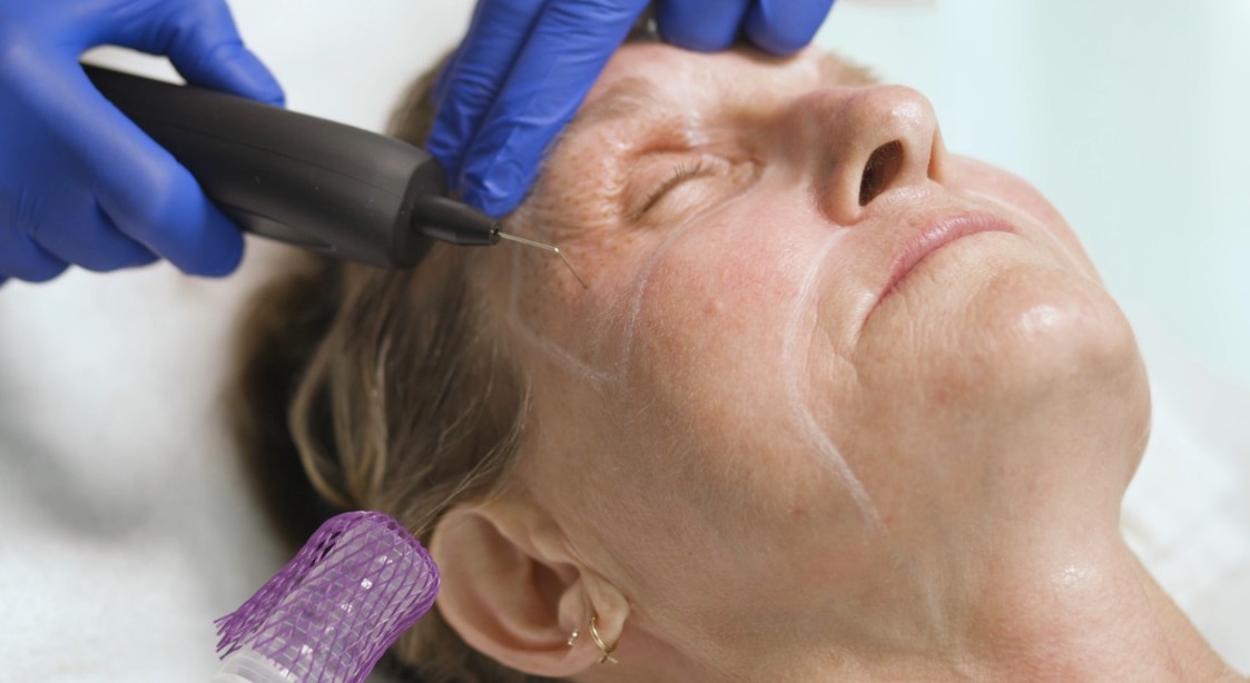 DLK_Plasma_IQ_Treatment DLK_Plasma_IQ_Treatment