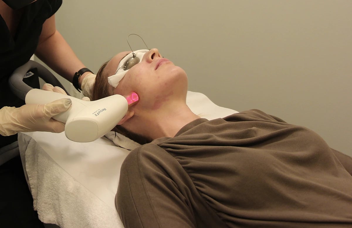 Non-Ablative Laser Resurfacing Treatment-1