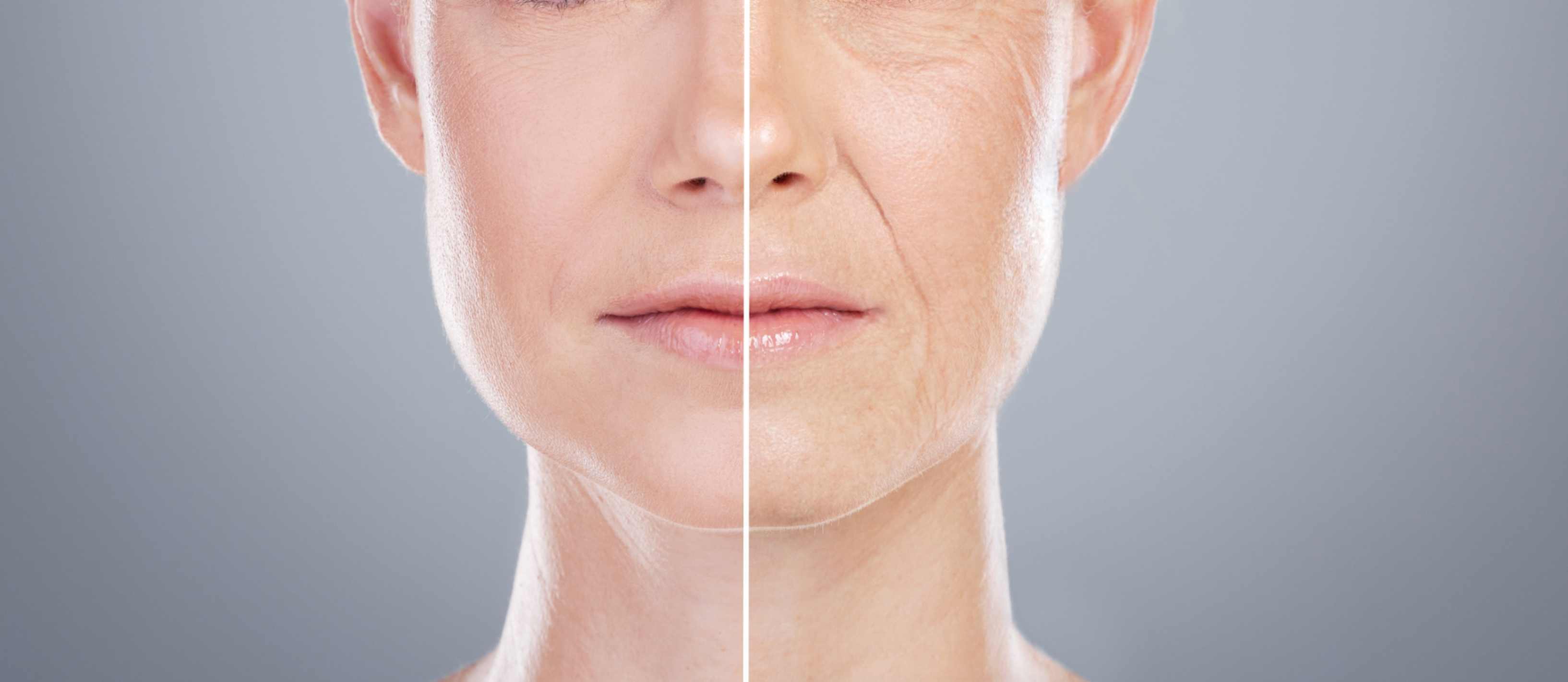 Top Non-Surgical Anti-Aging Treatments